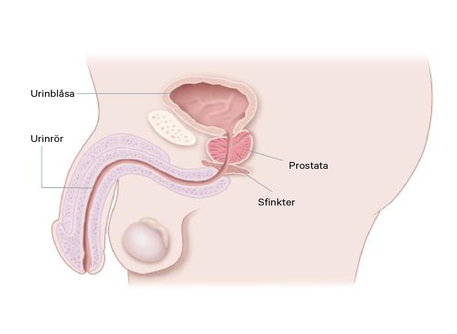 operation av prostata operation av prostata